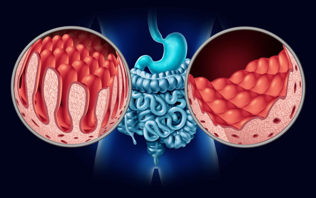 Digestive Disorders and Disability Insurance: What You Need to Know