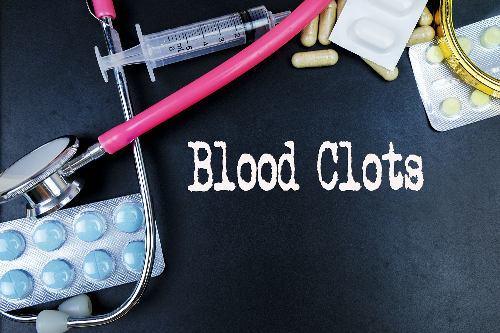 Understanding Clotting Disorders, Deep Vein Thrombosis, and Lymphedema:  Causes, Symptoms, and Treatment